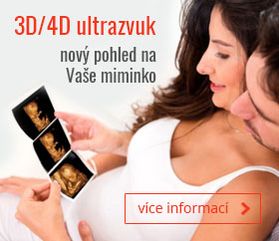 3D/4D ultrazvuk